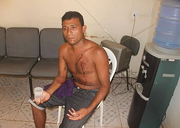 Mulher revoltada com alcoolismo do marido tenta matá-lo no bairro Calafate