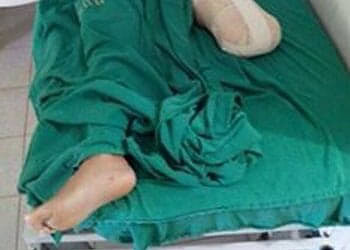 Vítima da imprudência do trânsito na Capital