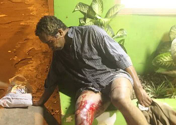 Ananias estaria bebendo, quando foi esfaqueado