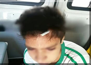 Aluno crava lápis na cabeça de colega durante discussão