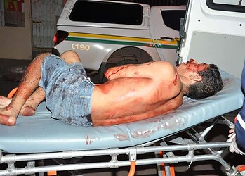 Vítima foi socorrida pelo Samu e submetida a uma cirurgia