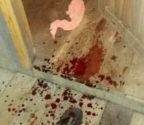 Mulher é esfaqueada várias vezes no bairro Boa União