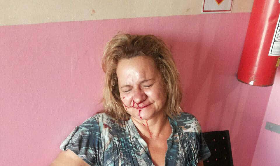 Luiza Vieira, 48, foi socorrida pelos agentes penitenciários e levada ao Pronto Socorro do Hospital do Juruá