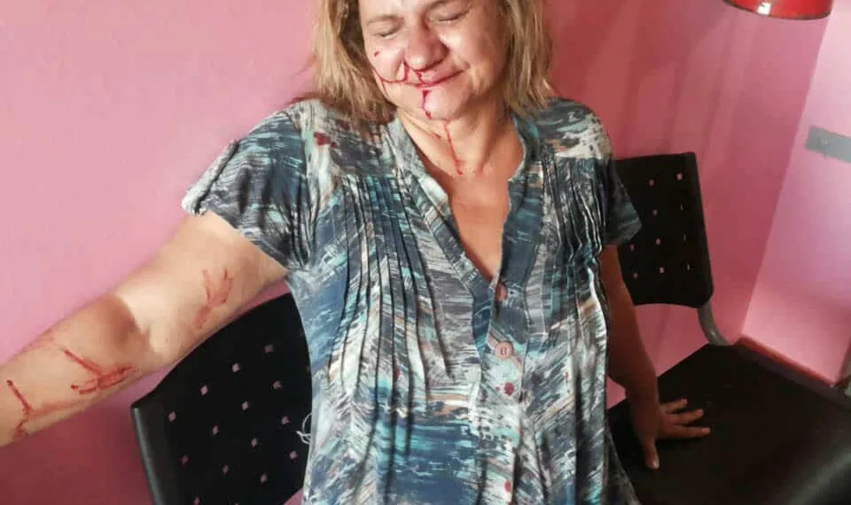 Luiza Vieira, 48, foi socorrida pelos agentes penitenciários e levada ao Pronto Socorro do Hospital do Juruá