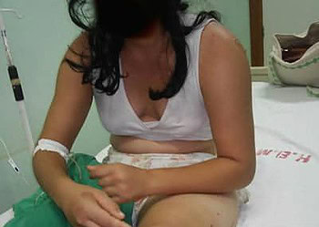 A jovem foi internada no Hospital Geral de Acrelândia