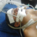 Irmãos gêmeos são assaltados e um deles é baleado na cabeça por ter pouco dinheiro
