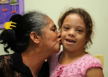 Portadores da síndrome de Down são assistidos por serviços da Sesacre