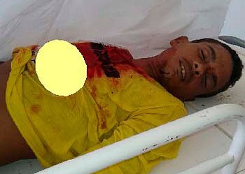 Anderson teria sido executado; polícia já tem suspeito