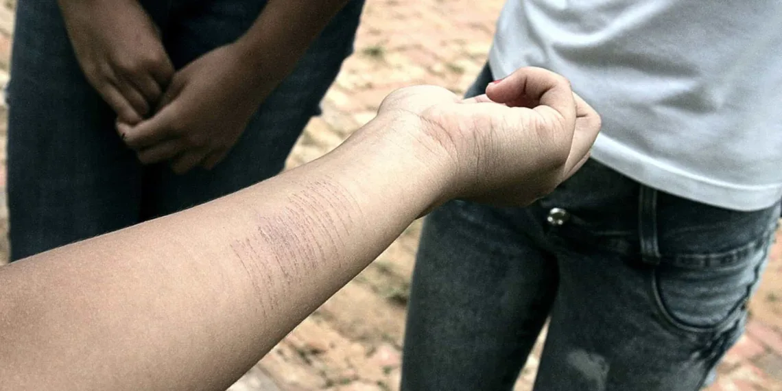 Depressão leva estudantes e praticarem a auto-mutilação. (Foto: Odair Leal/ A GAZETA)
