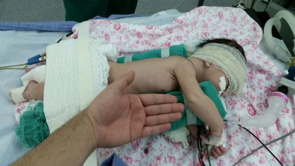 O pequeno Rafael aguarda alta hospitalar após cirurgia no pulmão. (Foto: Junior Aguiar Sesacre)