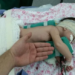 O pequeno Rafael aguarda alta hospitalar após cirurgia no pulmão. (Foto: Junior Aguiar Sesacre)