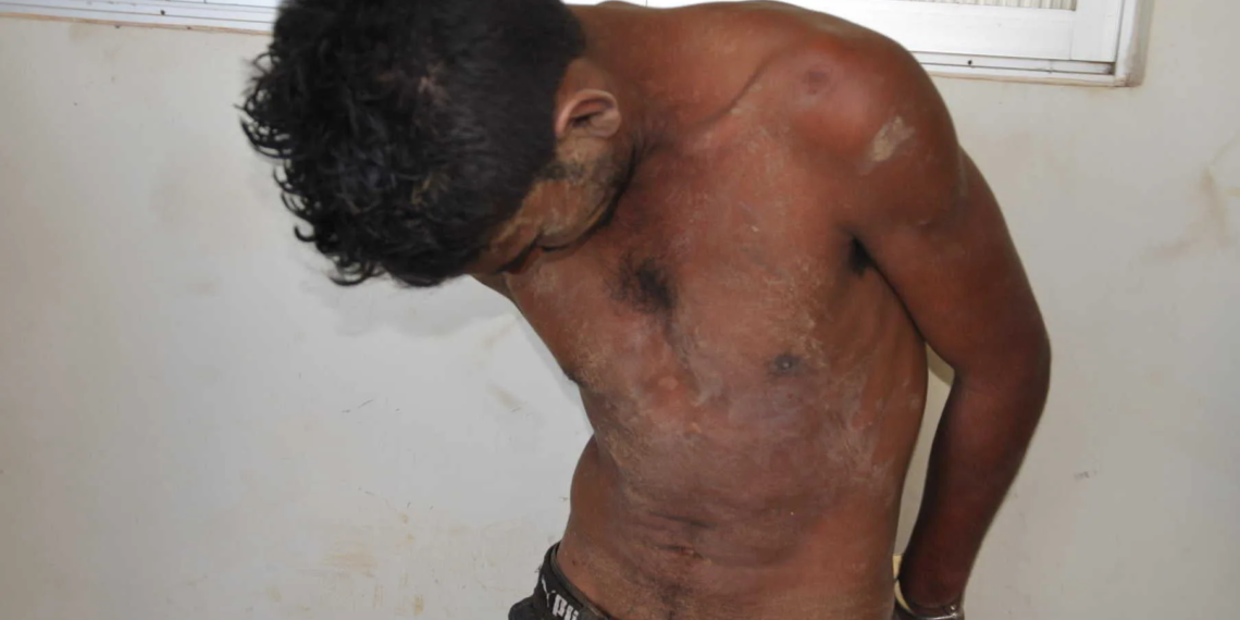 Homem é preso acusado de espancar mulher grávida