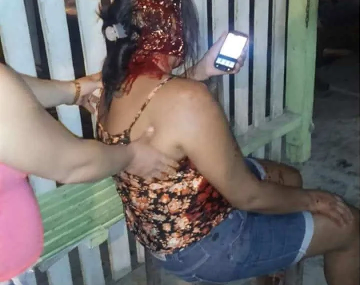 Agressão ocorreu em um bar no município de Feijó