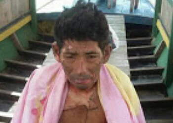 Homem é queimado vivo após discussão com amigo