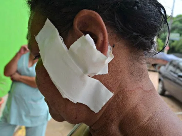 Aposentada de 58 anos, dona da chácara, teve parte da orelha cortada durante assalto