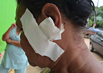 Aposentada de 58 anos, dona da chácara, teve parte da orelha cortada durante assalto