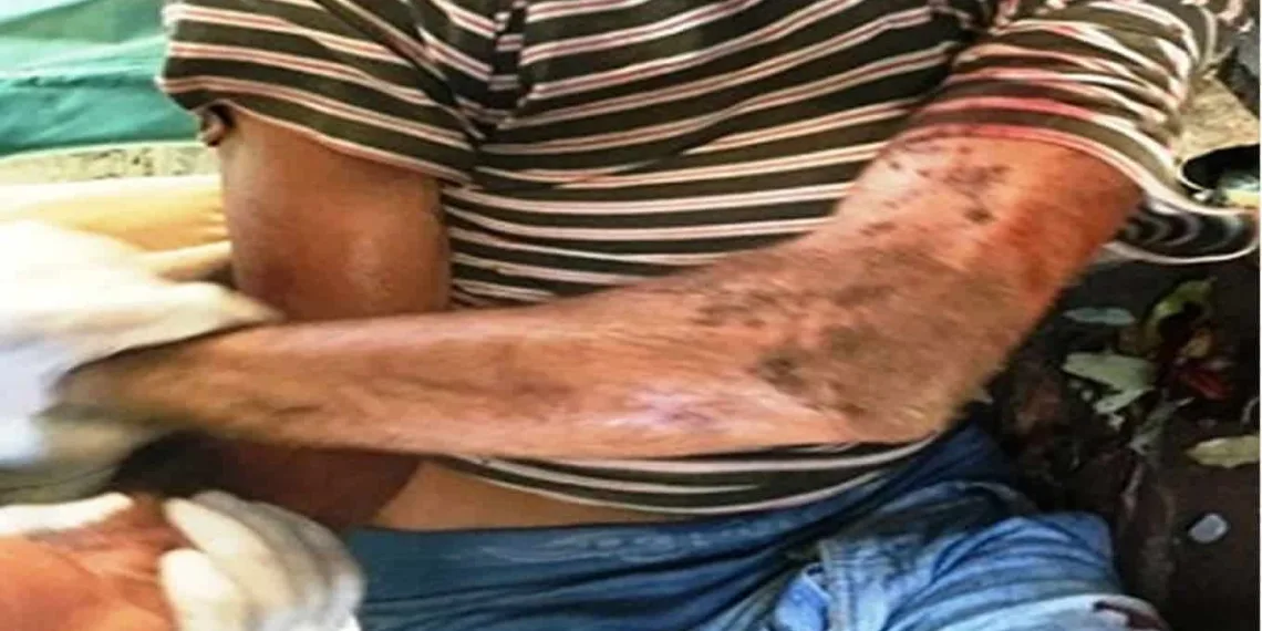 Homem invade gráfica, rende funcionário com gilete, mas acaba sendo linchado
