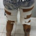 Polícia Civil prende “mula do tráfico” com drogas coladas ao corpo