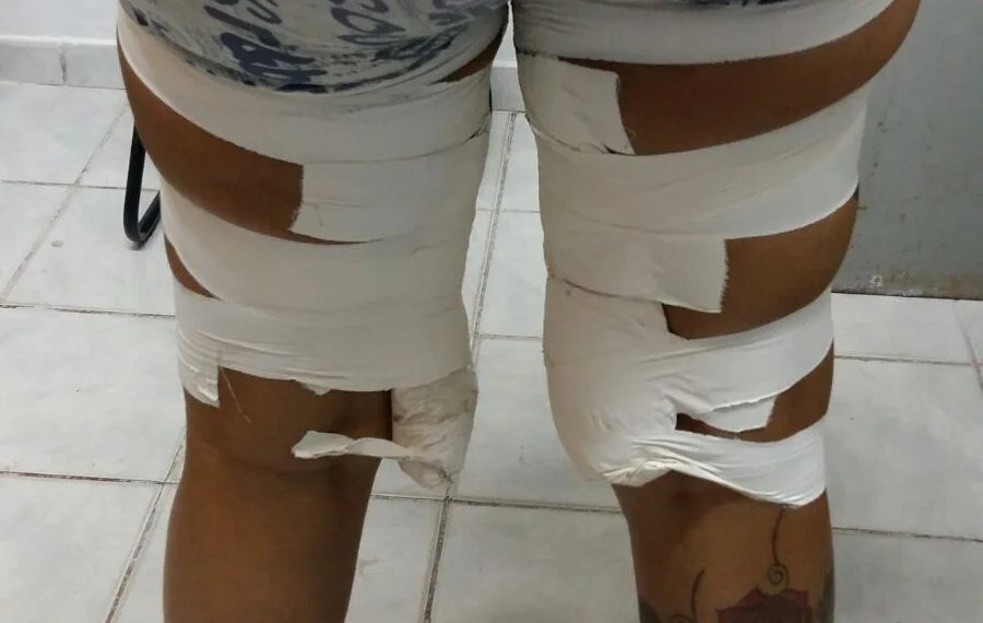 Polícia Civil prende “mula do tráfico” com drogas coladas ao corpo
