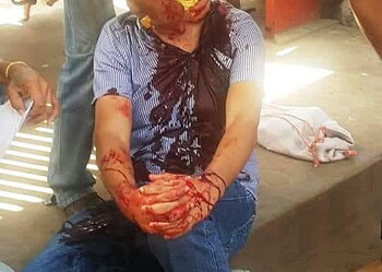 Discussão entre taxistas termina com um esfaqueado, perto do Terminal