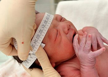 No Acre, 20 casos de microcefalia estão sob investigação; 17 já foram descartados