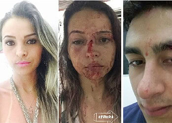 Pâmela Alves e seu namorado, sargento Lourenço, mostram como ficaram após agressões