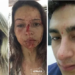 Pâmela Alves e seu namorado, sargento Lourenço, mostram como ficaram após agressões