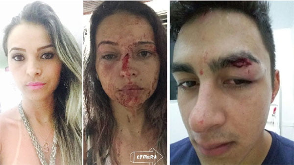 Pâmela Alves e seu namorado, sargento Lourenço, mostram como ficaram após agressões