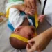 Ministério da Saúde confirma 35 casos de microcefalia em uma semana