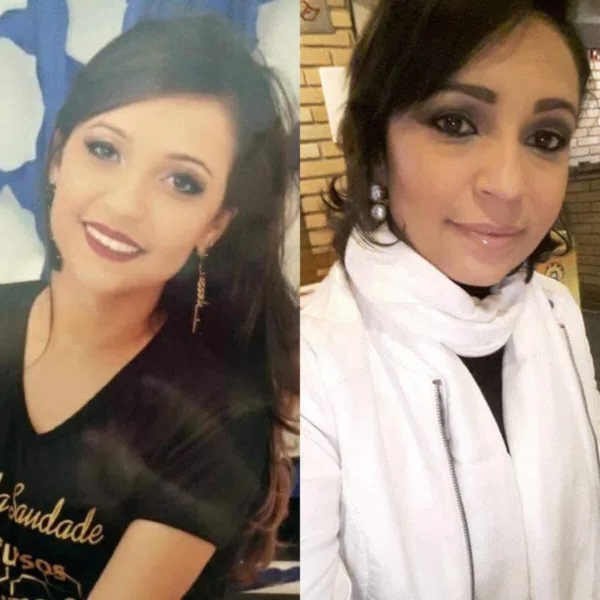 Após doença voltar, acreana faz transplante autólogo e vence câncer