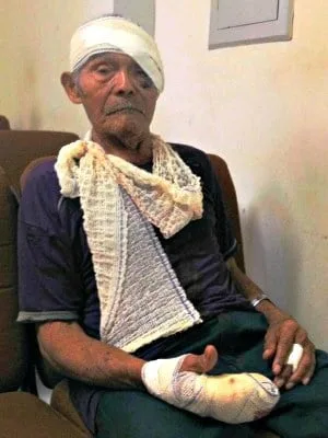 Aposentado de 81 anos reage a assalto, se fere, mas afugenta ladrão