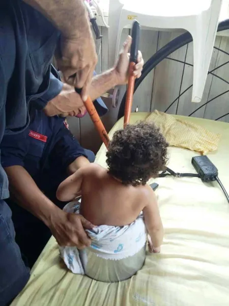 Bombeiros retiram criança presa em panela de pressão em Brasileia