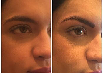 Clínica vai doar procedimentos de micropigmentação paramédica para acreanas que enfrentaram o câncer