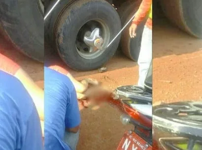 Mulher tem perna dilacerada por carreta na capital