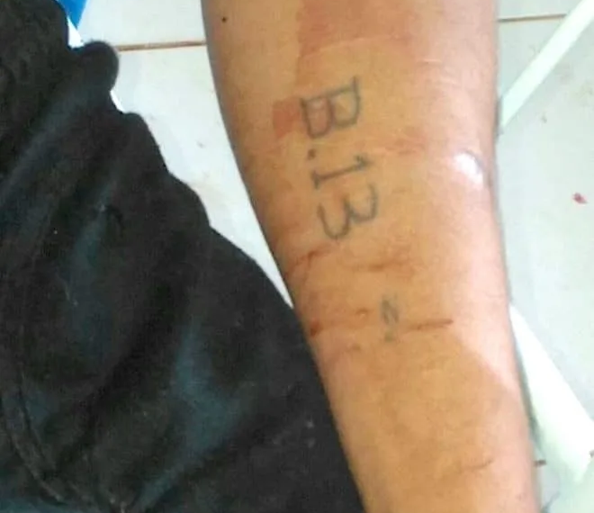 Jovem com tatuagem de facção é morto a tiros