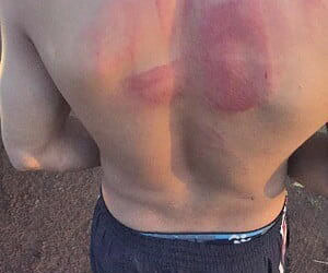 Bandidos invadem chácara da família do senador Petecão e torturam caseiro