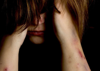 Violence victim
