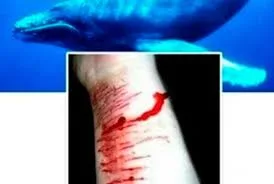 Artigo: Adolescentes em risco de suicídio e o jogo da Baleia Azul