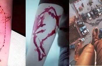 Psicóloga orienta como proteger a família desse desafio nocivo 20 Jovens são induzidos a se mutilarem após aceitarem o jogo