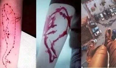 Jovens são induzidos a se mutilarem após aceitarem o jogo