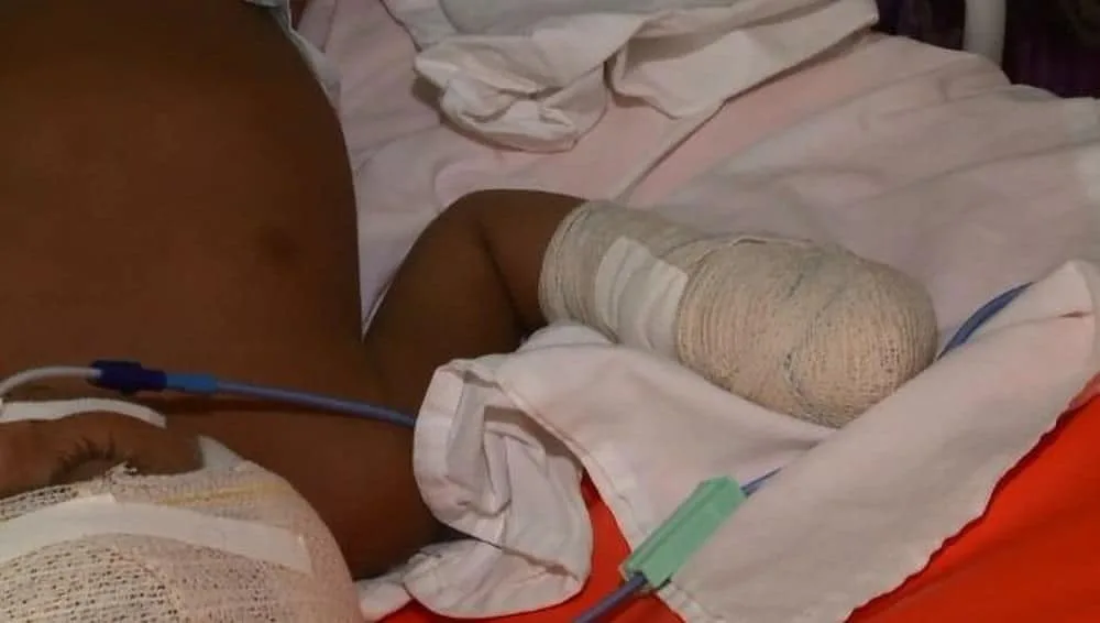 Bebê baleado na cabeça em Rio Branco perdeu parte do cérebro, diz diretora da UTI