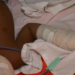 Bebê baleado na cabeça em Rio Branco perdeu parte do cérebro, diz diretora da UTI