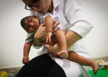 Bebês com zika terão núcleo de apoio para acompanhamento e estímulo precoce