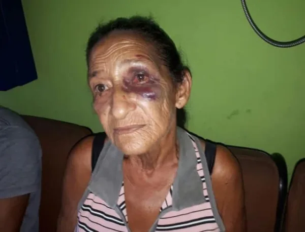 Idosa é espancada durante tentativa de estupro e acusa jovem de 15 anos 1 Idosa é espancada durante tentativa de estupro e acusa jovem de 15 anos