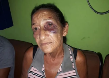 Idosa é espancada durante tentativa de estupro e acusa jovem de 15 anos