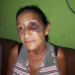 Idosa é espancada durante tentativa de estupro e acusa jovem de 15 anos