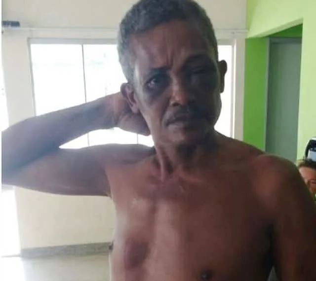 Filhas espancam e amarram agricultor após ver mãe sendo agredida