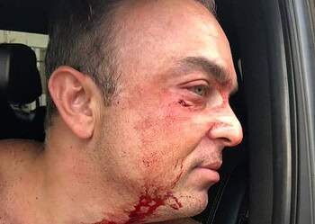 “Nem sei quem é este rapaz”, diz secretário sobre agressão em saída de boate