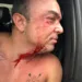 “Nem sei quem é este rapaz”, diz secretário sobre agressão em saída de boate