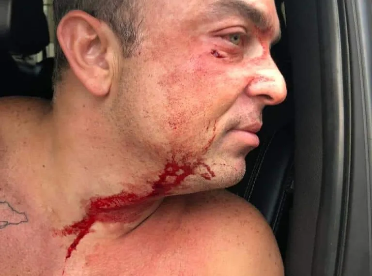 “Nem sei quem é este rapaz”, diz secretário sobre agressão em saída de boate